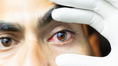 Glaucoma, un paziente su due non sa di averlo: diagnosi e terapie